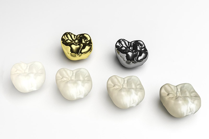 Dental crowns in Sage hill